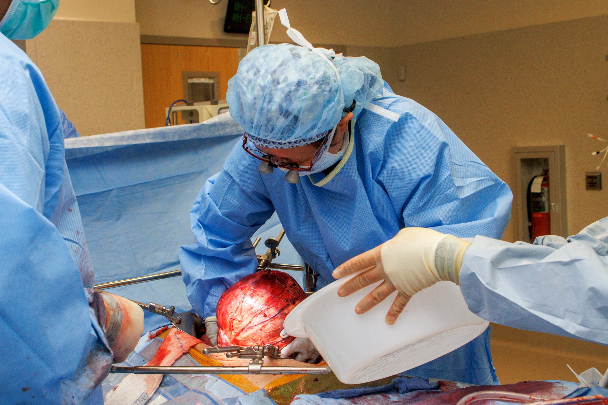 Dr Han in surgery at Mayo Clinic AZ
