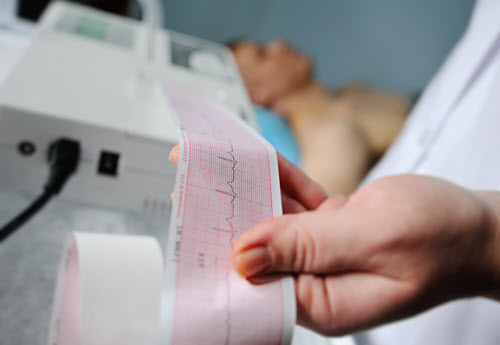 EKG-heart-test-result