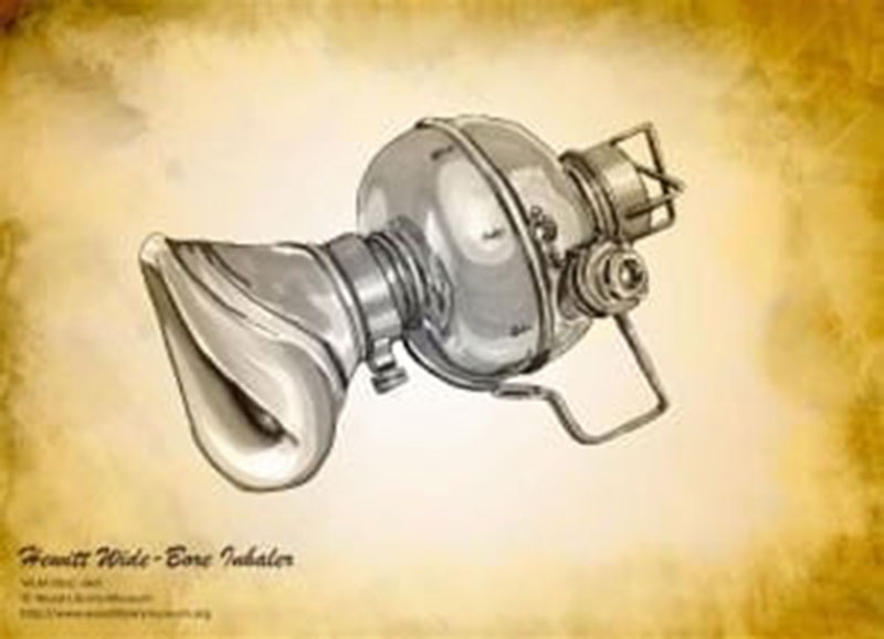 Medical Milestones: Discovery of Anesthesia & Timeline