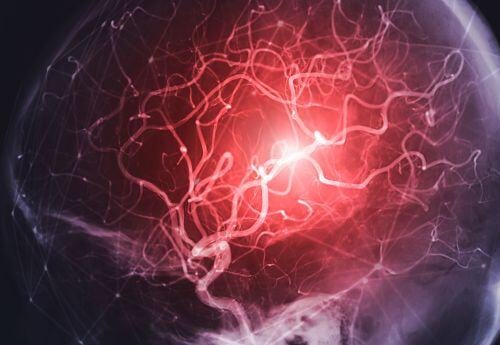 IR-doctor-looking-at-brain-imaging
