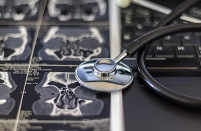 Otorhinolaryngology sinus xrays