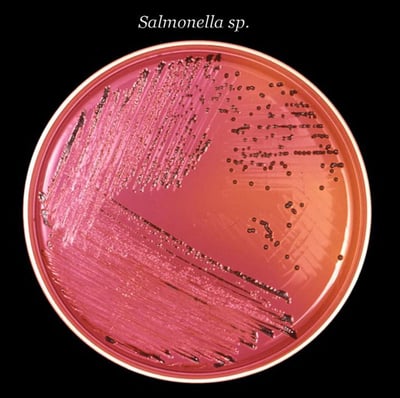 SALMONELLA: Pictured growing on a petri dish. Photo: AP/CDC
