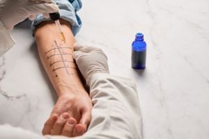allergist-doing-allergy-testing