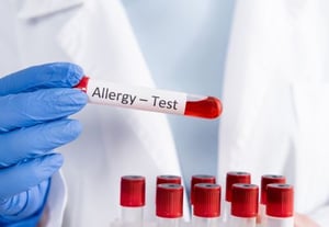 allergist-serum