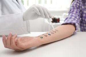allergy-testing-on-arm