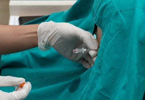 anesthesiologist-performing-lumbar-puncture