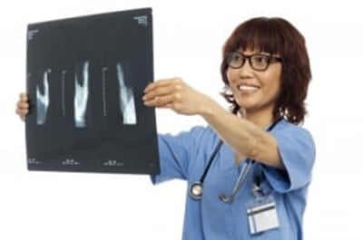 OSTEOPOROSIS RISKS: Asian American women have a high risk of osteoporosis because of lower bone mass and density, smaller body frames & other factors. Photo: FreeDigitalPhotos.net
