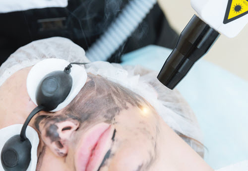 dermatologic laser procedure