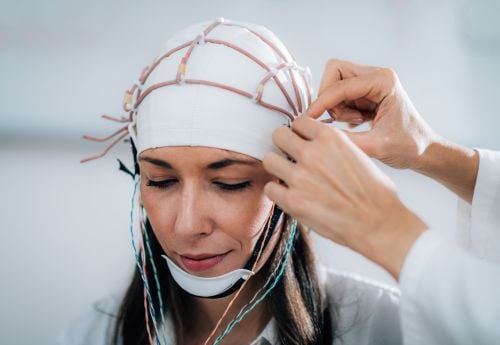 eeg-scan-performed-by-neurologist