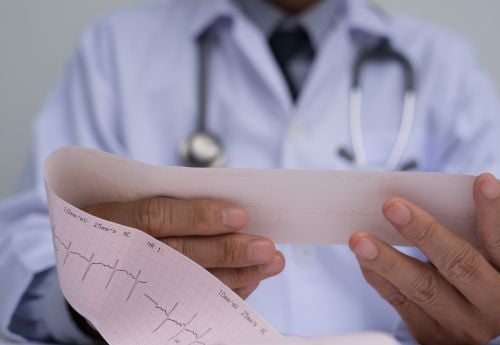ekg-cardiology-heart-test-results