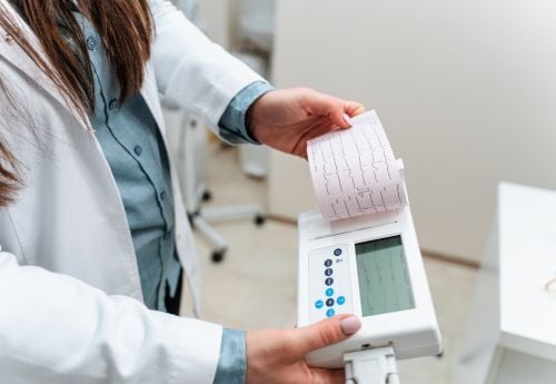 heart-rhythm-ekg-cardiologist