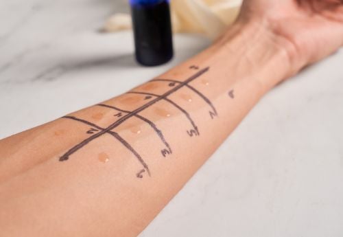 immunology-allergy-testing