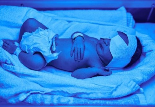 infant-in-blue-light-for-jaundace