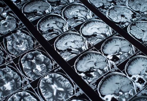 neurologic-surgeon-with-mri-of-brain