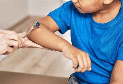 neurological-testing-on-arm