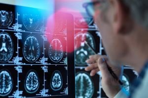neurologist-viewing-brain-scans