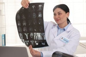 neurologist-viewing-scans