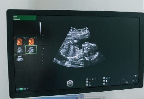ob-gyn-showing-sonongram