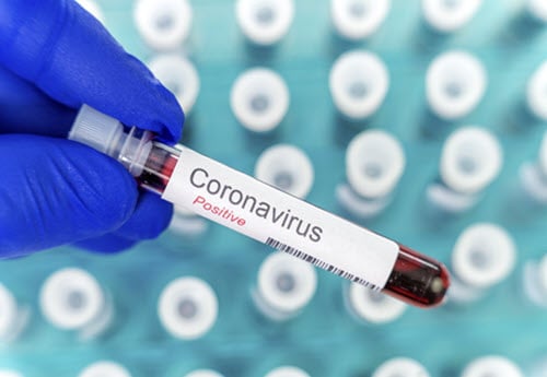 pathology blood sample dr coronavirus positive dignosis