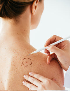 steps-to-becoming-a-dermatologist-doctor