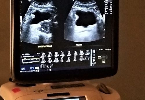 ultasound-scan-of-kidneys-and-prostate