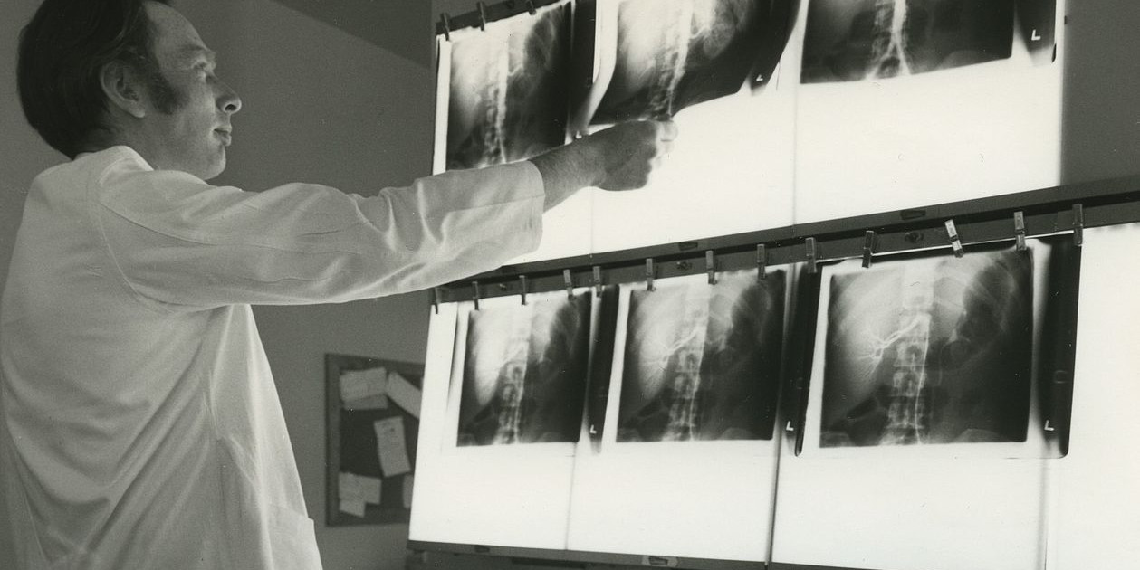 Medical Milestones Invention of the XRay