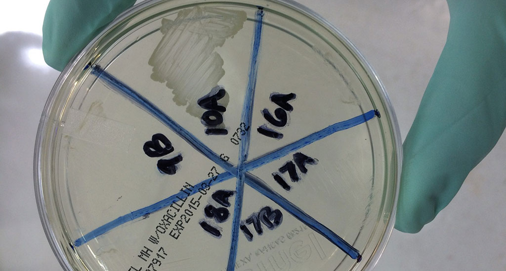 Oxacillin-resistant-Staph-aureus-isolate